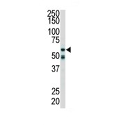 Receptor Interacting Serine Threonine Kinase 2 (RIPK2) Antibody