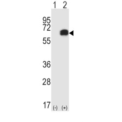 Receptor Interacting Serine Threonine Kinase 2 (RIPK2) Antibody