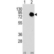 Transglutaminase Antibody