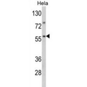WB analysis of HeLa cell lysates.