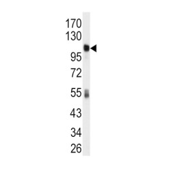 Aldehyde Dehydrogenase 1 Family Member L1 (ALDH1L1) Antibody