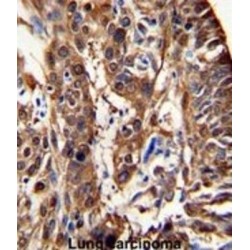 Aldehyde Dehydrogenase 3 Family Member A1 (ALDH3A1) Antibody