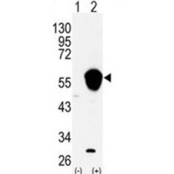 Aldehyde Dehydrogenase 3 Family Member A1 (ALDH3A1) Antibody