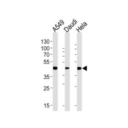 Aldehyde Dehydrogenase 3 Family Member A1 (ALDH3A1) Antibody