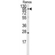 Endoplasmic Reticulum Aminopeptidase 1 (ARTS1) Antibody