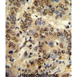 PK3CA Antibody