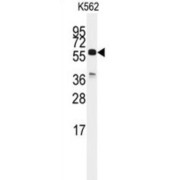 Cell Division Cycle 25C (CDC25C) Antibody