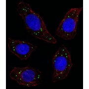 Tyrosine-Protein Kinase Mer (MERTK) Antibody