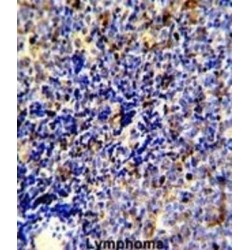 Tyrosine-Protein Kinase Mer (MERTK) Antibody