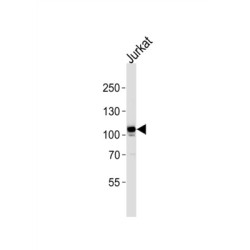 Tyrosine-Protein Kinase Mer (MERTK) Antibody