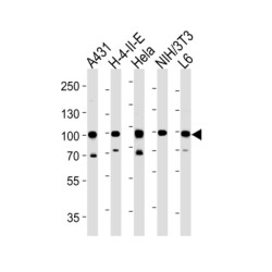 Heat Shock Protein 90kDa Alpha B1 (HSP90AB1) Antibody