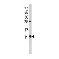 FK506 Binding Protein 1B (FKBP1B) Antibody