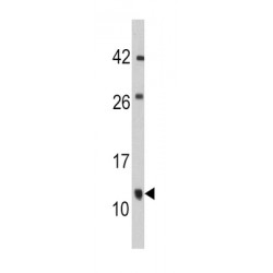 FK506 Binding Protein 1B (FKBP1B) Antibody