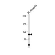 AMP Deaminase 3 (AMPD3) Antibody