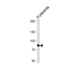 AMP Deaminase 3 (AMPD3) Antibody