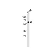 Estrogen-Related Receptor Gamma (ESRRG) Antibody