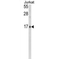 Glia Maturation Factor Gamma (GMFG) Antibody