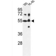 Steroid 21-Hydroxylase (CYP21A2) Antibody