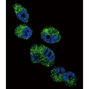 Cytochrome P450 4A11 (CYP4A11) Antibody