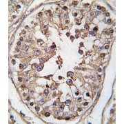 TANK-Binding Kinase 1 (TBK) Antibody