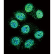 Polyunsaturated Fatty Acid Lipoxygenase ALOX15 (ALOX15) Antibody