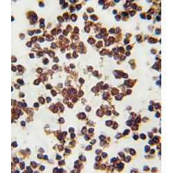 Polyunsaturated Fatty Acid Lipoxygenase ALOX15 (ALOX15) Antibody