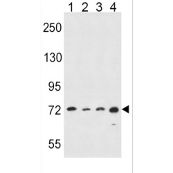 Polyunsaturated Fatty Acid Lipoxygenase ALOX15 (ALOX15) Antibody