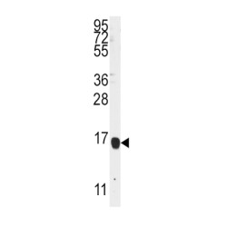 Arachidonate 5-Lipoxygenase-Activating Protein (ALOX5AP) Antibody