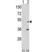 WB analysis of (1) non-transfected, and (2) AIK-transfected 293 cell lysates.