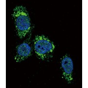 Hexokinase-4 (GCK) Antibody