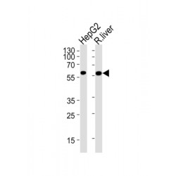Hexokinase-4 (GCK) Antibody