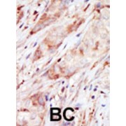 Hexokinase-4 (GCK) Antibody