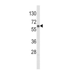 Hexokinase-4 (GCK) Antibody