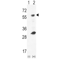 Hexokinase-4 (GCK) Antibody