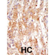 MAPK/ERK Kinase Kinase 6 (MEKK6) Antibody