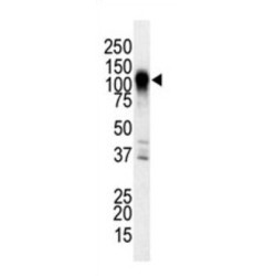 MAPK/ERK Kinase Kinase 6 (MEKK6) Antibody