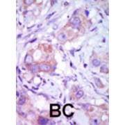 MLK1 Antibody