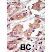 Mixed Lineage Kinase 2 (MLK2) Antibody