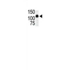 Mixed Lineage Kinase 2 (MLK2) Antibody