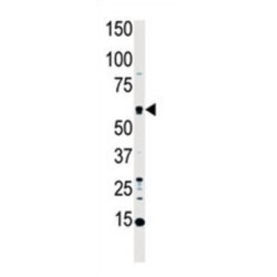 Macrophage Stimulating Protein/Hepatocyte Growth Factor Like (MST1) Antibody