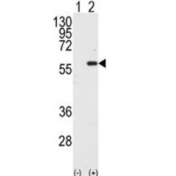 Macrophage Stimulating Protein/Hepatocyte Growth Factor Like (MST1) Antibody