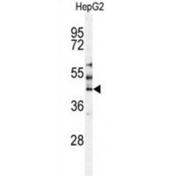 Mammalian STE20-Like Protein Kinase 3 (MST3) Antibody