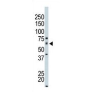 WB analysis of Mouse Small Intestine Tissue.