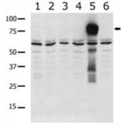 Serine/Threonine-Protein Kinase PAK 5 (PAK5) Antibody