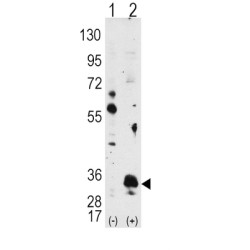 Serine/Threonine-Protein Kinase Pim-1 (PIM1) Antibody