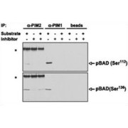 Serine/Threonine-Protein Kinase Pim-2 (PIM2) Antibody