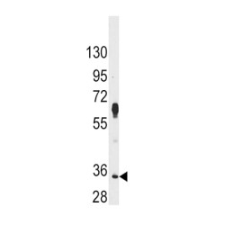 Serine/Threonine-Protein Kinase Pim-2 (PIM2) Antibody