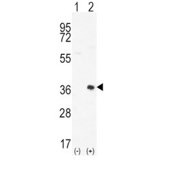 Serine/Threonine-Protein Kinase Pim-2 (PIM2) Antibody