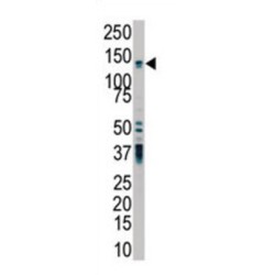 Protein Kinase D2 (PKD2) Antibody