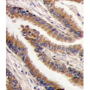 cAMP-Dependent Protein Kinase Catalytic Subunit PRKX (PRKX) Antibody